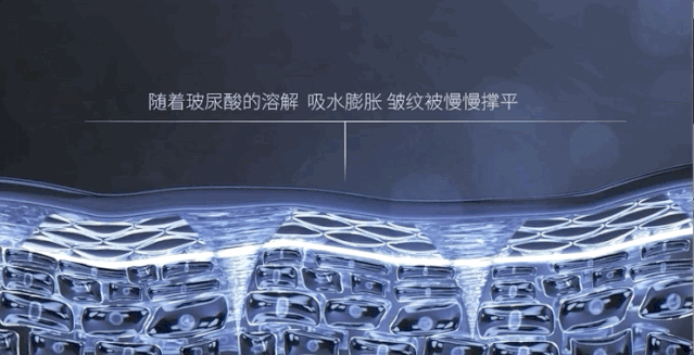 它把玻尿酸制成了200微米长度的微针,而眼睑皮肤的厚度只有100微米,这