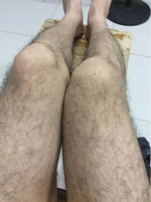 激光脱腿毛对皮肤有危害吗