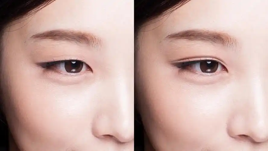 用ps处理人像将单眼皮变成双眼皮,效果逼真的无法相信-天天办公网