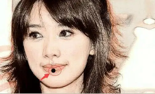 四种一夜暴富的痣相好运缠身金银万贯