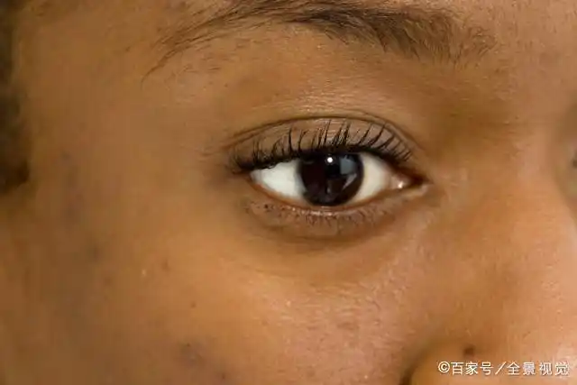 则透气过程不畅,导致皮肤色泽不好,甚至出现脸色发黑,暗沉没有色泽的