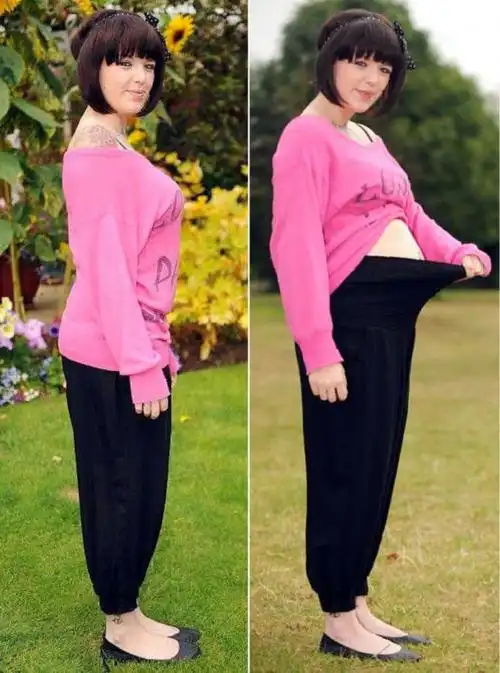 lasenfermedadescuriosas