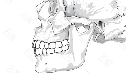 【step1】咨询牙齿的情况【step2】拍摄全景片【step3】用口扫仪器