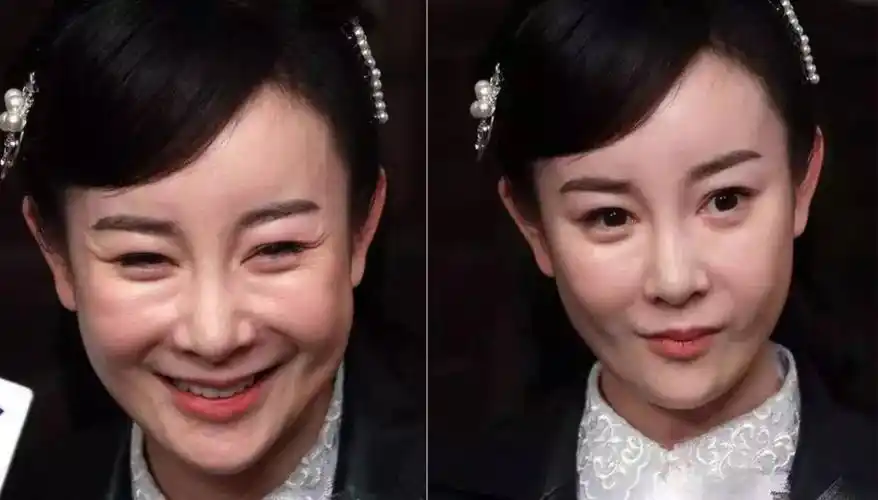 女孩整容失败降智至一岁,容貌焦虑真的只能去整容了吗?辣目洋子:我知