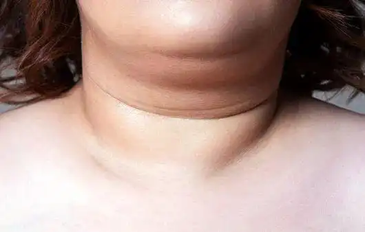 天鹅颈就一定好看吗仰头才是鉴美颈的唯一金标准