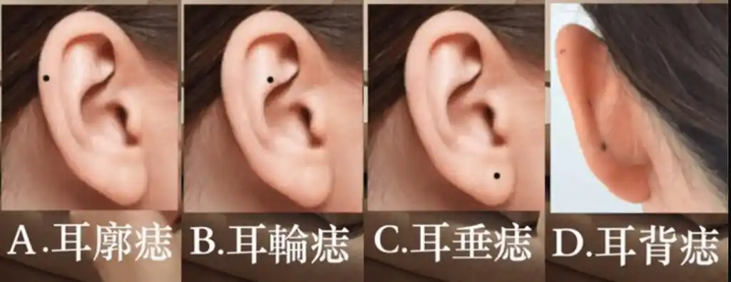 从耳朵分析命运