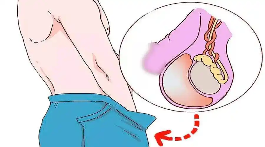 男人得了甲减要警惕蛋蛋的忧伤