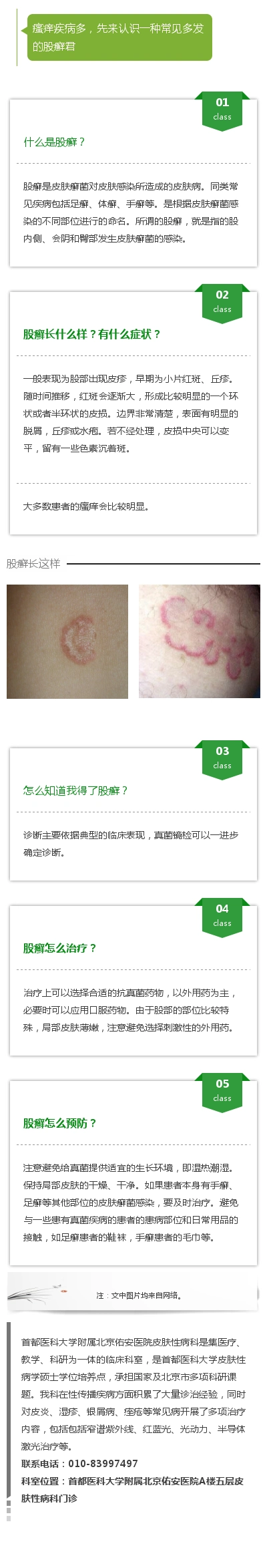 关于股癣的一些问题