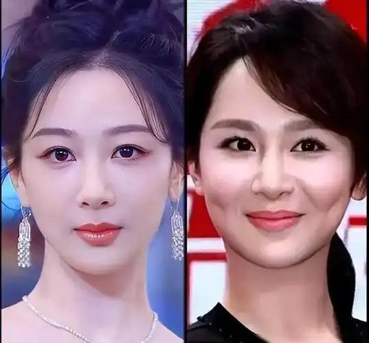 32岁杨紫深陷容貌焦虑?最新状态上热搜,脸部馒化肿胀变化大|演员|整容