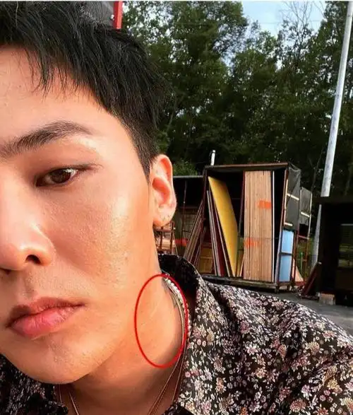 照片中的权志龙感觉有些 疲惫, 脸上有好多的小颗粒,也不知道是闭口