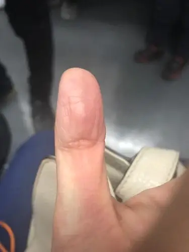 我这个是凤眼纹吗?我里面还有一个闭合的椭圆轮廓.