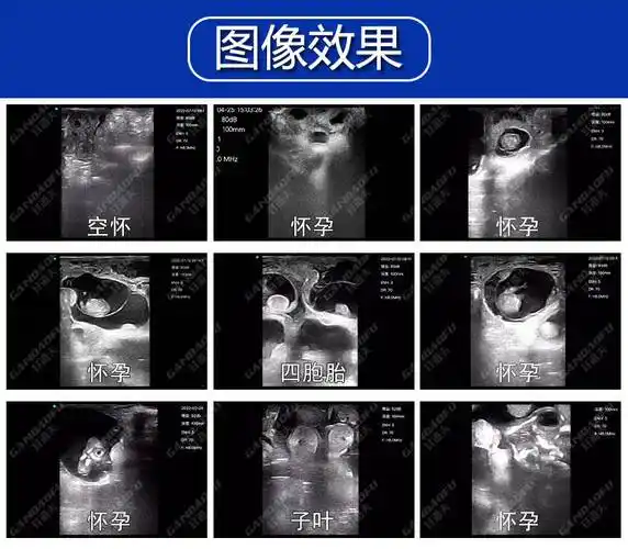 兽用无线b超检查羊怀孕不同时期超声影像二,兽用无线b超gdf-c80技术
