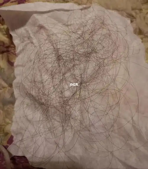 不知道100根头发大概有多少的看这里