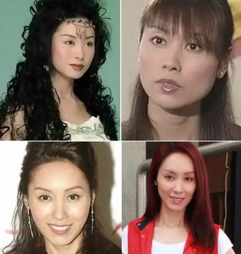 【香港整容失败老明星】_香港整容失败的女星_香港女星整容失败案例6