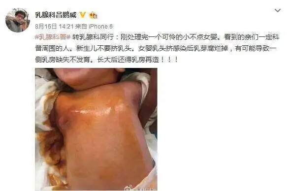 2,不要给宝宝绑腿