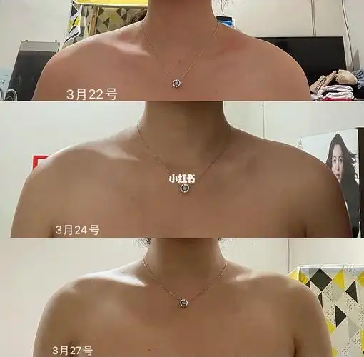 背厚了怎么回事_美丽芭蕾_欧阳春晓_斜方肌_运动健身_健身_徒手健身