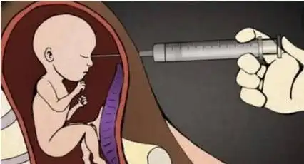 孩子两个月能打掉吗(2023今日更新)