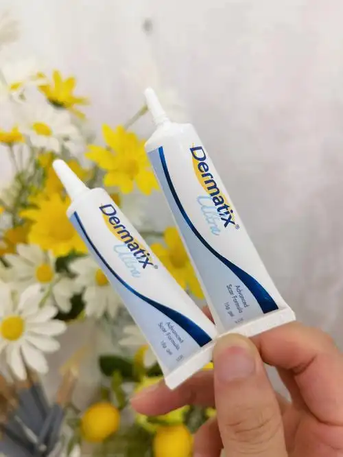 祛疤膏用对告别疤痕困扰了