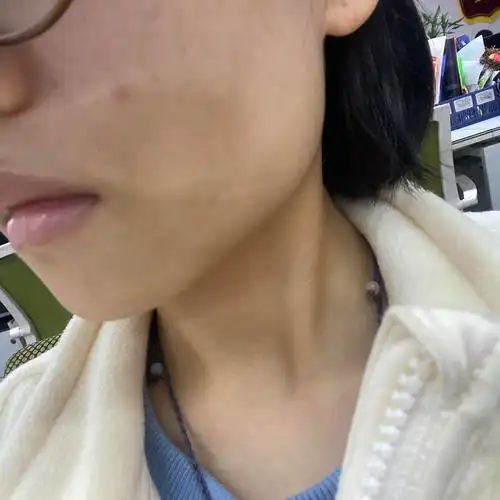 有没有姐妹跟我一样脸部肤色不均匀