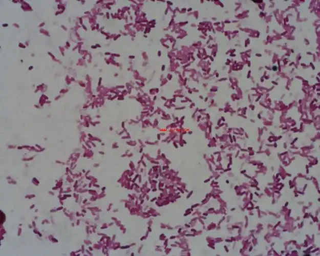 求各种细菌的显微镜图片