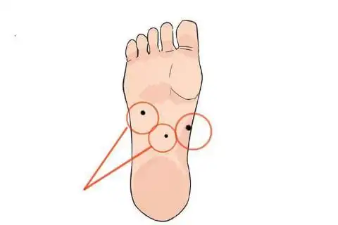 脚上长痣图解大全