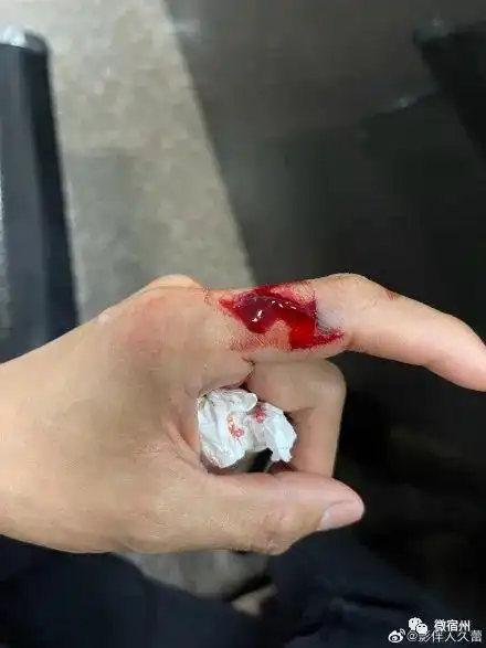 举着血淋淋的手指求助!