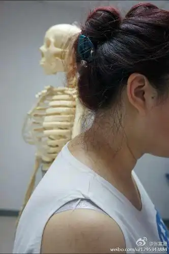 矫正驼背,可以瘦身!