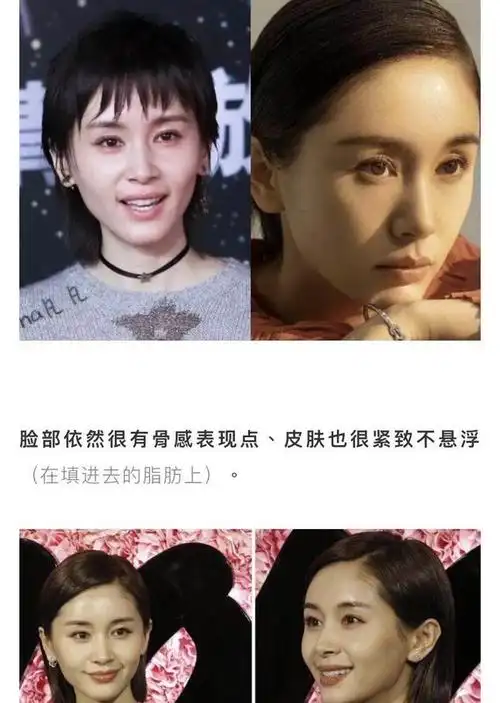 新氧体验官我觉得王子文就是我填充界的天花板