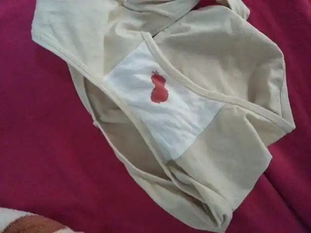 孕20周,早上上完厕所,换内裤,过两分钟有血(有图,不喜勿进)