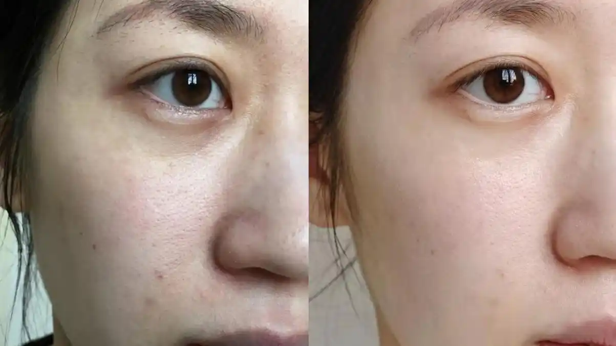 市场上针对护肤的家用美容仪器基本分为光能美容仪,精华水光仪两种