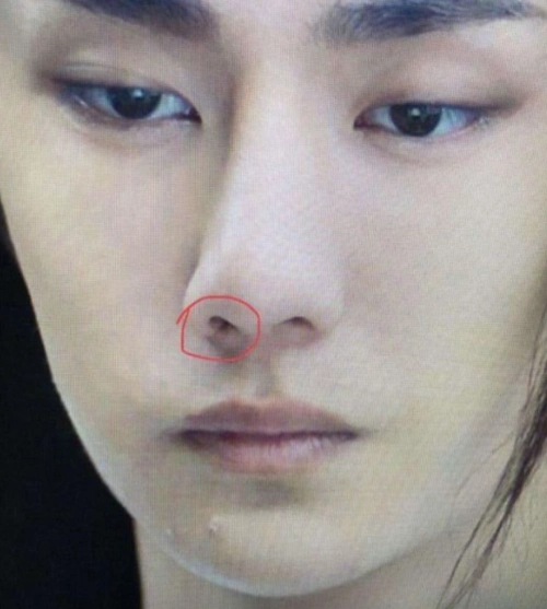 王一博鼻子是受过伤吗?有说是骑车摔的!