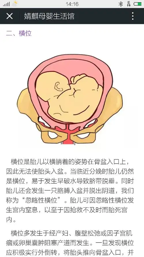 横位的宝宝很危险,怎么办!