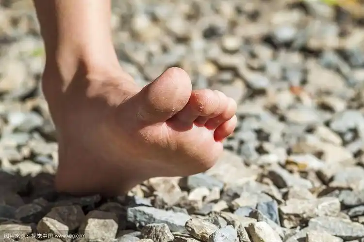 赤脚在石头上行走的特写,户外活动