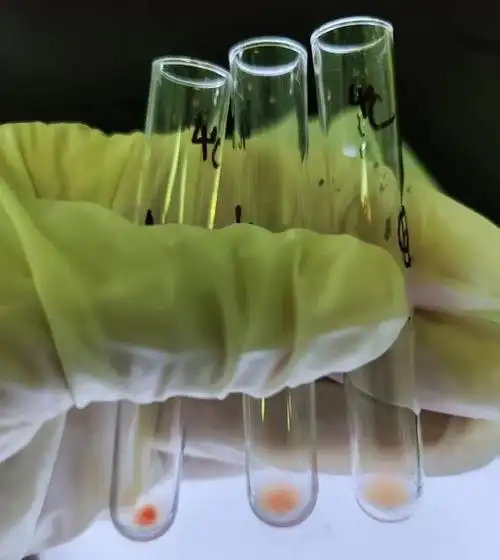 下患者正定型结果不规则抗体筛查1-3号谱细胞均出现凝集,没有反应格局