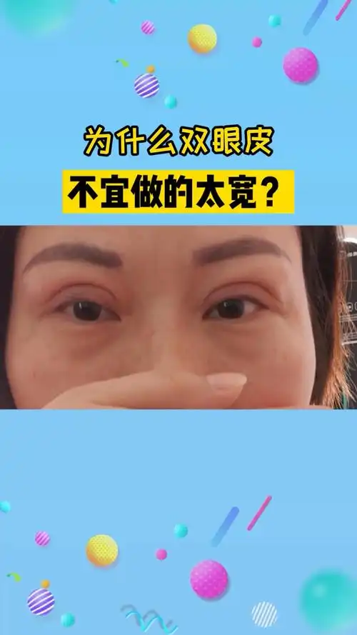 双眼皮不建议做太宽,容易变成这样的