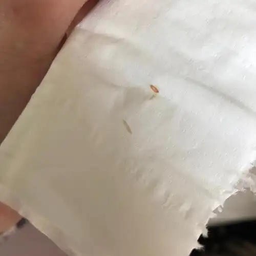 最近床上出现了图中的虫子 白色透明 蠕动的 还有像蛹一样的东西 前