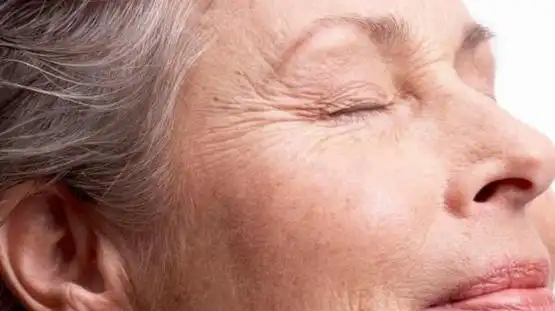 面部凹陷,老化,三种常见医美改变状态,看看你适合哪一种?