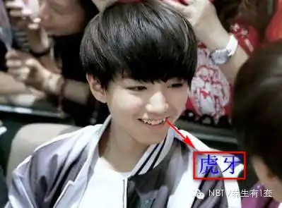 长了"虎牙"后应去医院就诊,医生会根据儿童的情况给予治疗.