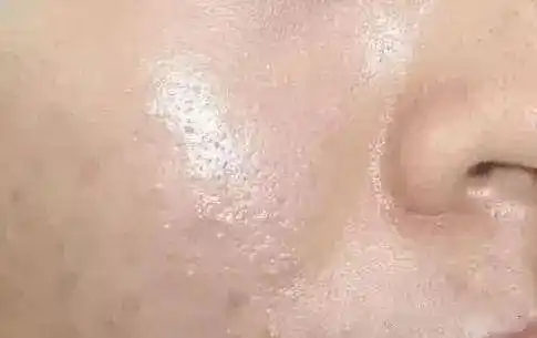 油皮夏日护肤第一步必须是摆脱油腻零死角洗净油光脏污