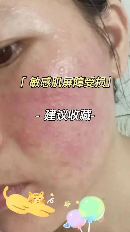 皮肤屏障受损是常见的皮肤问题,但却非常容易被忽略!反而更 - 抖音