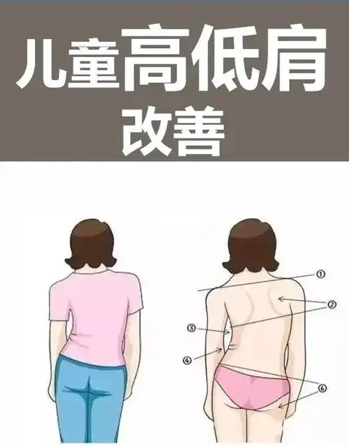 儿童高低肩改善