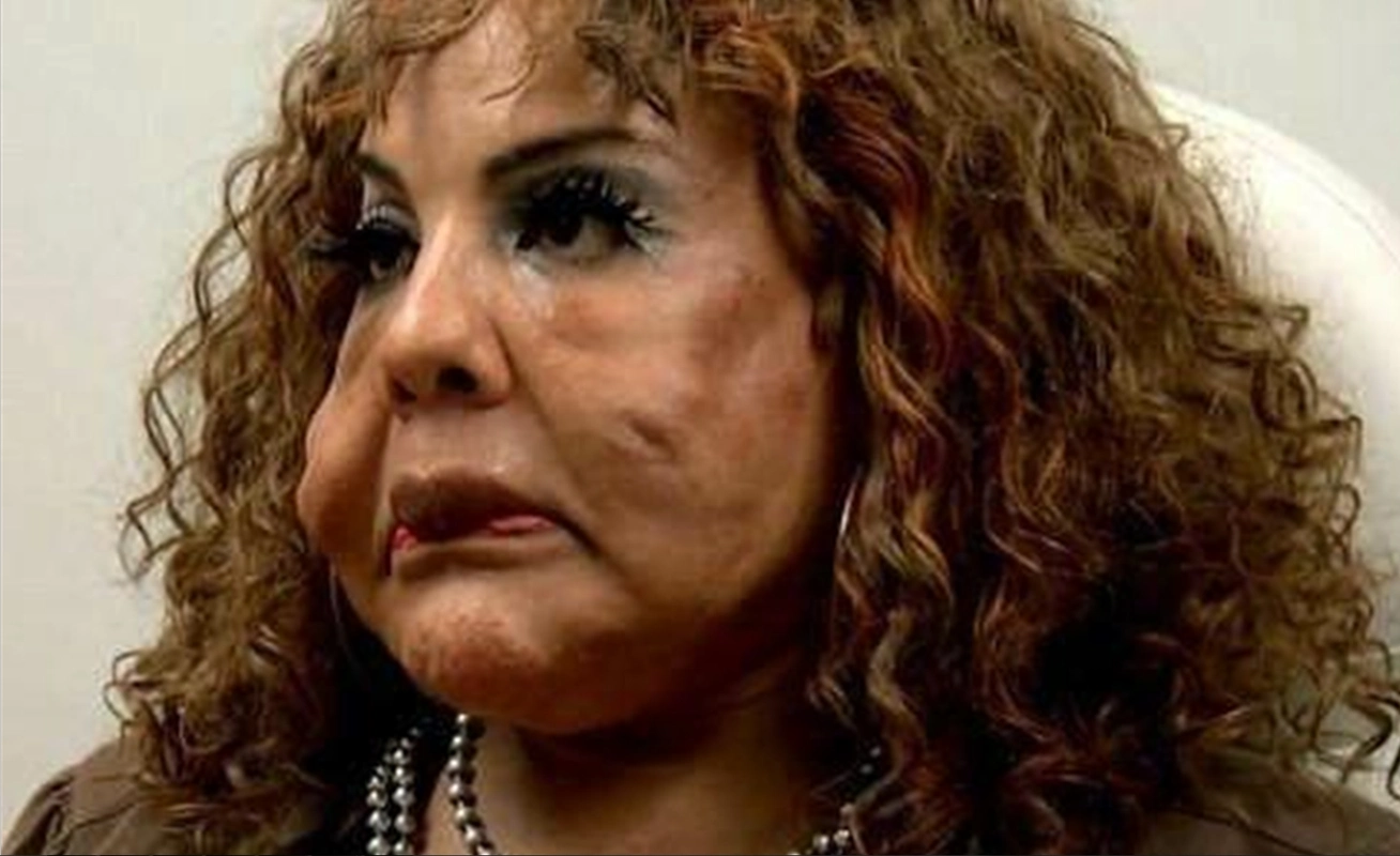 韩国女星整容失败,变得好吓人!网友:这是怪物吧!