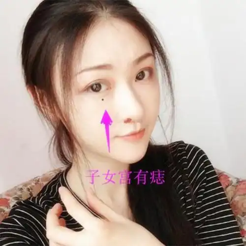 女人有这三颗克夫痣要么赶紧处理要么别怪丈夫能力差