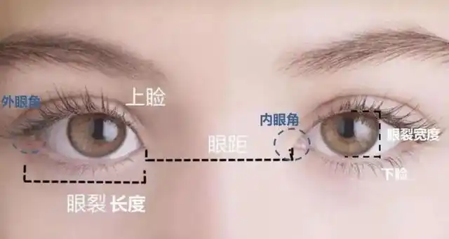 为什么不推荐大家做夸张的眼睑下至?关键是需要考虑这些方面