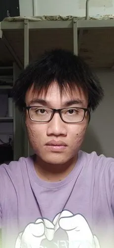 男生长得丑还留长发是什么体验?