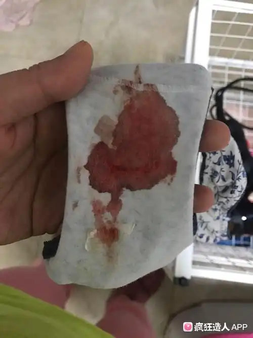 排卵期出血,这样的血量正常吗?