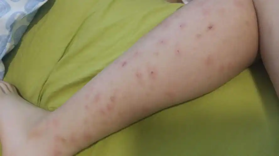 谁知道这些黑点点怎么搞掉?