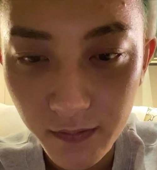 原创黄子韬直播截图被疯传无美颜下痘痘黑头明显这肤色是真实的吗