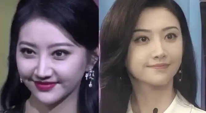 景甜颜值状态的坎坷路就是不断的医美恢复期啊