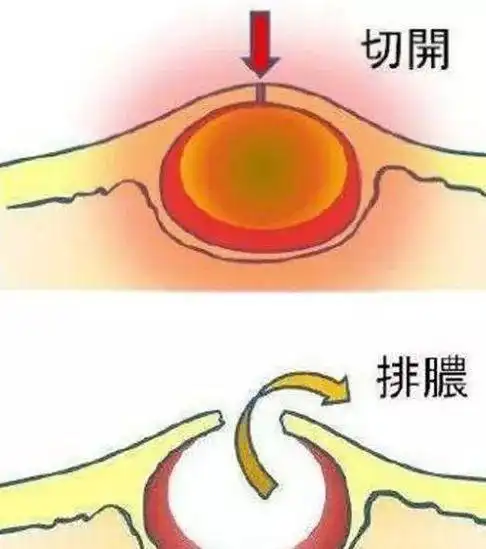 耳朵后面长疙瘩这几种情况要注意